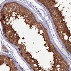 HINT1 Antibody, Novus Biologicals 0.1mL; Unlabeled:Antibodies