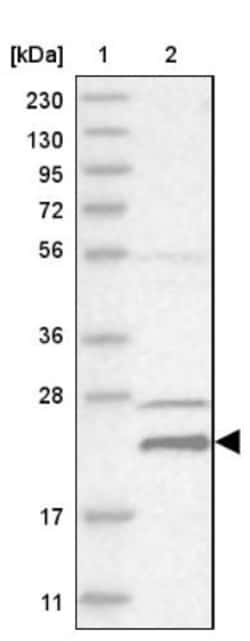 HINT3 Antibody, Novus Biologicals 25 &mu;L; Unlabeled:Antibodies, Polyclonal