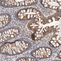HINT3 Antibody, Novus Biologicals 25 &mu;L; Unlabeled:Antibodies, Polyclonal