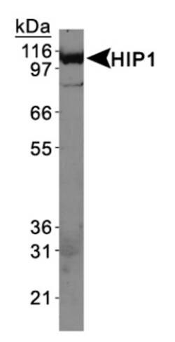 HIP1 Antibody (4B10), Novus Biologicals:Antibodies:Primary Antibodies