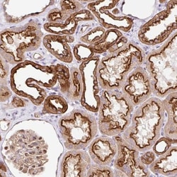 HIP1 Related Antibody, Novus Biologicals 0.1mL; Unlabeled:Antibodies, Polyclonal