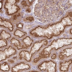 HIP1 Related Antibody, Novus Biologicals:Antibodies:Primary Antibodies