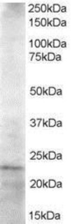 UBE2K/E2-25K Antibody, Novus Biologicals 0.1mg; Unlabeled:Antibodies, Polyclonal