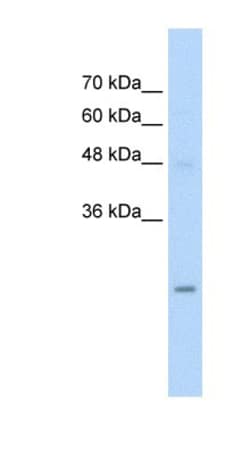 UBE2K/E2-25K Antibody, Novus Biologicals 100 ul; Unconjugated:Antibodies,