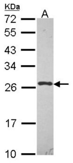 UBE2K/E2-25K Antibody, Novus Biologicals 0.1mL; Unlabeled:Antibodies, Polyclonal