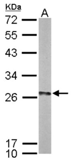 UBE2K/E2-25K Antibody, Novus Biologicals 0.1mL; Unlabeled:Antibodies, Polyclonal