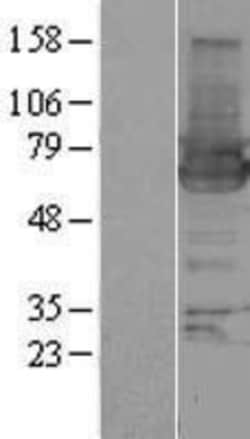 Novus Biologicals™ HIP-55 Overexpression Lysate