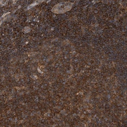 HIP-55 Antibody, Novus Biologicals 0.1mL; Unlabeled:Antibodies, Polyclonal