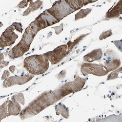 HIPK2 Antibody, Novus Biologicals 25 &mu;L; Unlabeled:Antibodies, Polyclonal