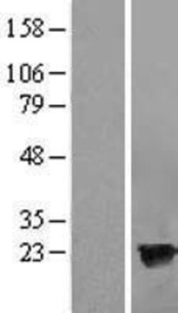 Novus Biologicals&trade;&nbsp;Hippocalcin like 4 Overexpression Lysate