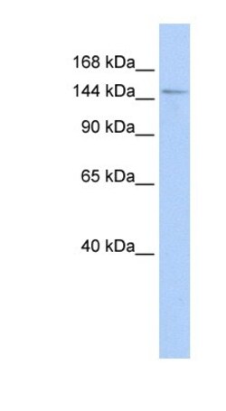 HISPPD1 Antibody, Novus Biologicals:Antibodies:Primary Antibodies
