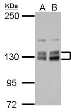 HISPPD1 Antibody, Novus Biologicals 0.1mL; Unlabeled:Antibodies, Polyclonal