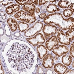 HISPPD1 Antibody, Novus Biologicals 25 &mu;L | Buy Online | Novus Biologicals | Fisher Scientific