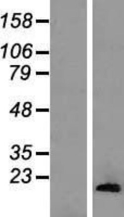 Novus Biologicals&trade;&nbsp;HIST1H2AA Overexpression Lysate