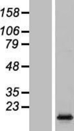 Novus Biologicals™ HIST1H2AC Overexpression Lysate