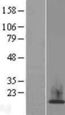Novus Biologicals™ HIST1H2AH Overexpression Lysate