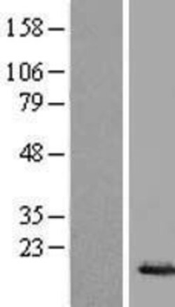 Novus Biologicals&trade;&nbsp;HIST1H2BE Overexpression Lysate