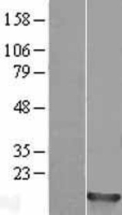 Novus Biologicals HIST1H2BM Overexpression Lysate 0,1 mg | Buy Online | Novus Biologicals&trade; | Fisher Scientific
