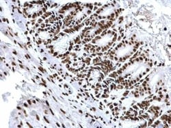 HIST1H3A, ac Lys18 Antibody, Novus Biologicals 0.1mL:Antibodies, Polyclonal