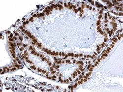HIST1H3A, ac Lys18 Antibody, Novus Biologicals 0.1mL:Antibodies, Polyclonal