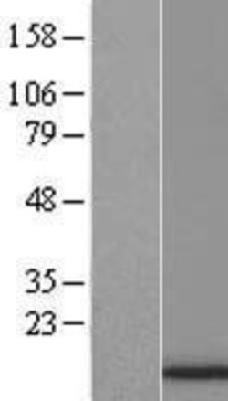 Novus Biologicals&trade;&nbsp;HIST1H4F Overexpression Lysate