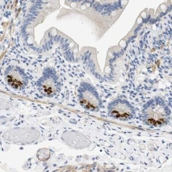 Histamine H2R Antibody, Novus Biologicals 0.1mL; Unlabeled:Antibodies,