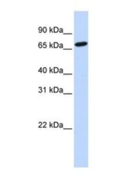 Histidase Antibody, Novus Biologicals 20μL; Unlabeled:Antibodies, Polyclonal