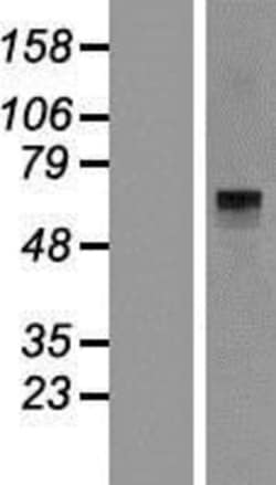 Novus Biologicals&trade;&nbsp;Histidase Overexpression Lysate