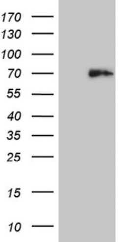 Histone Deacetylase 2/HDAC2 Antibody (OTI7E10), Novus Biologicals 0.1mL;