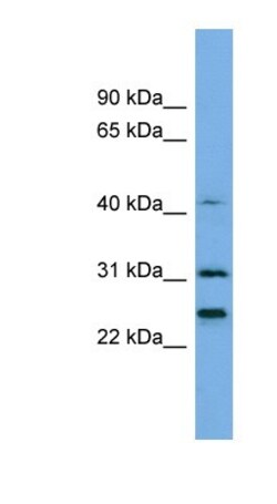 Histone H1.4 Antibody, Novus Biologicals 0.05mg; Unlabeled:Antibodies,