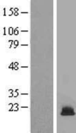 Novus Biologicals&trade;&nbsp;HIST1H3F Overexpression Lysate