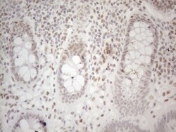 Histone Deacetylase 2/HDAC2 Antibody (OTI7E10), Novus Biologicals 0.1mL;