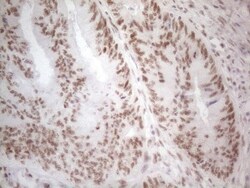 Histone Deacetylase 2/HDAC2 Antibody (OTI7E10), Novus Biologicals 0.1mL;