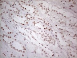 Histone Deacetylase 2/HDAC2 Antibody (OTI7E10), Novus Biologicals 0.1mL;