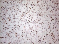 Histone Deacetylase 2/HDAC2 Antibody (OTI7E10), Novus Biologicals 0.1mL;
