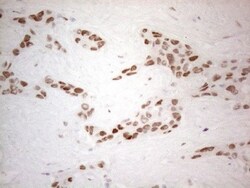 Histone Deacetylase 2/HDAC2 Antibody (OTI7E10), Novus Biologicals 0.1mL;