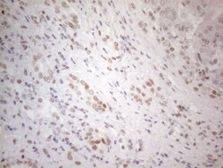 Histone Deacetylase 2/HDAC2 Antibody (OTI7E10), Novus Biologicals 0.1mL;