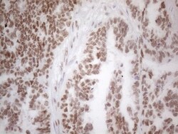 Histone Deacetylase 2/HDAC2 Antibody (OTI7E10), Novus Biologicals 0.1mL;
