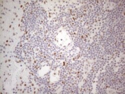 Histone Deacetylase 2/HDAC2 Antibody (OTI7E10), Novus Biologicals 0.1mL;