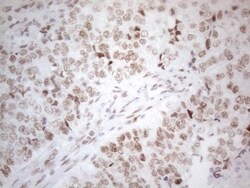 Histone Deacetylase 2/HDAC2 Antibody (OTI7E10), Novus Biologicals 0.1mL;