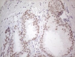 Histone Deacetylase 2/HDAC2 Antibody (OTI7E10), Novus Biologicals 0.1mL;