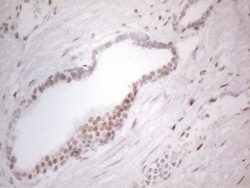 Histone Deacetylase 2/HDAC2 Antibody (OTI7E10), Novus Biologicals 0.1mL;