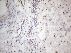 Histone Deacetylase 2/HDAC2 Antibody (OTI7E10), Novus Biologicals 0.1mL;