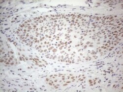 Histone Deacetylase 2/HDAC2 Antibody (OTI7E10), Novus Biologicals 0.1mL;