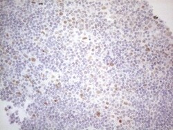 Histone Deacetylase 2/HDAC2 Antibody (OTI7E10), Novus Biologicals 0.1mL;