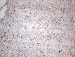 Histone Deacetylase 2/HDAC2 Antibody (OTI7E10), Novus Biologicals 0.1mL;