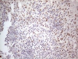 Histone Deacetylase 2/HDAC2 Antibody (OTI7E10), Novus Biologicals 0.1mL;