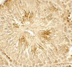 Histone Deacetylase 2/HDAC2 Antibody - BSA Free, Novus Biologicals 0.1mg;