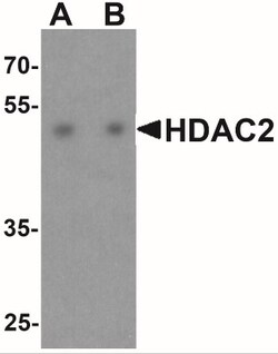 Histone Deacetylase 2/HDAC2 Antibody - BSA Free, Novus Biologicals 0.1mg;