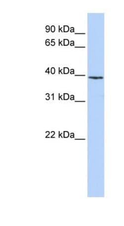 Histone H2AY/macroH2A.1 Antibody, Novus Biologicals:Antibodies:Primary